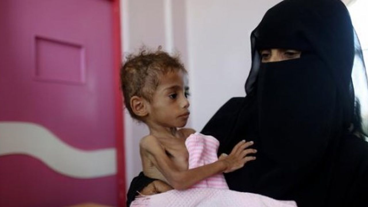 Yemen'de nüfusun yüzde 70'i açlıkla savaşıyor