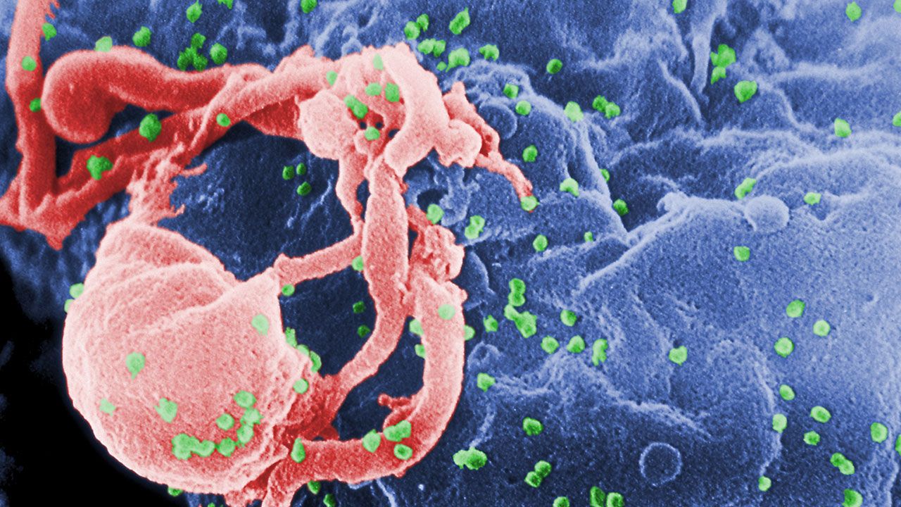 HIV pozitif tanısı konan hasta tedavi olmadan iyileşti