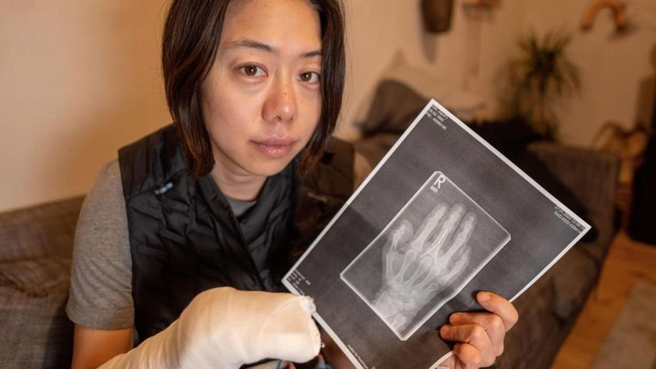 Berlin'de bilet görevlileri kadının parmağını kırdı
