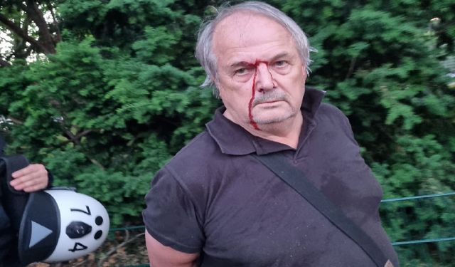 Almanya'da polis şiddeti: 72 yaşındaki avukat darp edildi