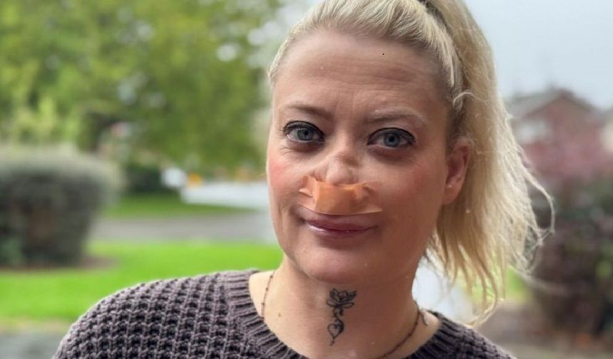 Türkiye’de diş ameliyatı sonrası burnundan nefes alamayan kadın